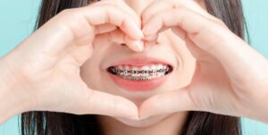 Braces on a Budget: Transform Your Smile Without Overspending