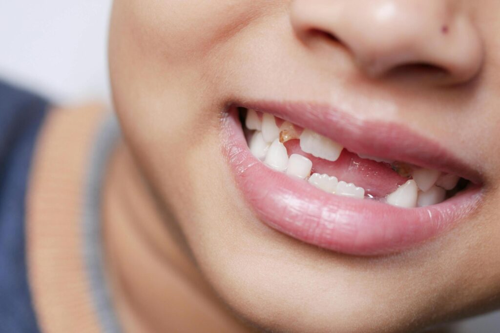 Tooth Pocket Treatment Options That Actually Work
