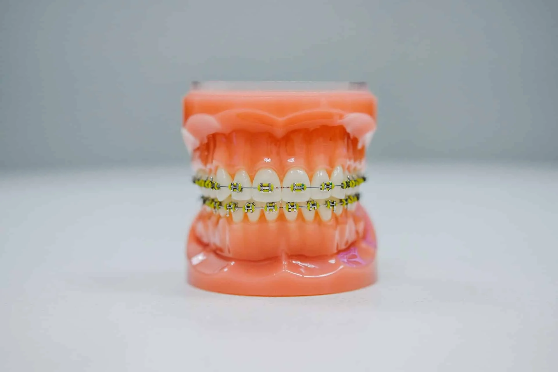 The Stages of Dental Braces Treatment: What to Expect