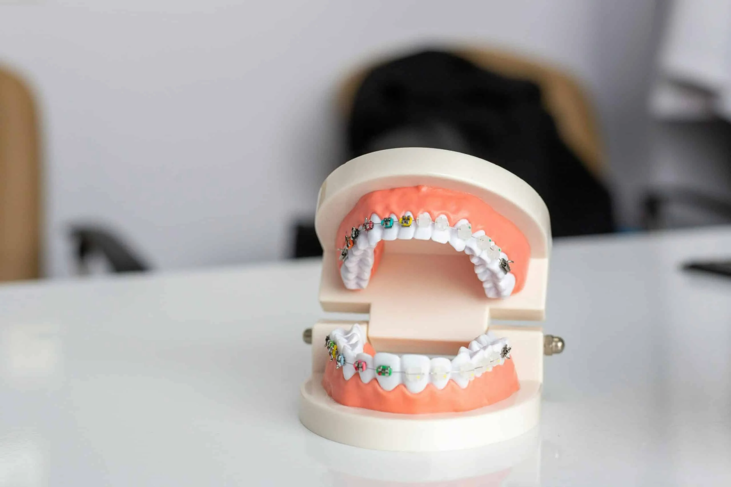 Braces Basics: Proven Stages for Effective Treatment