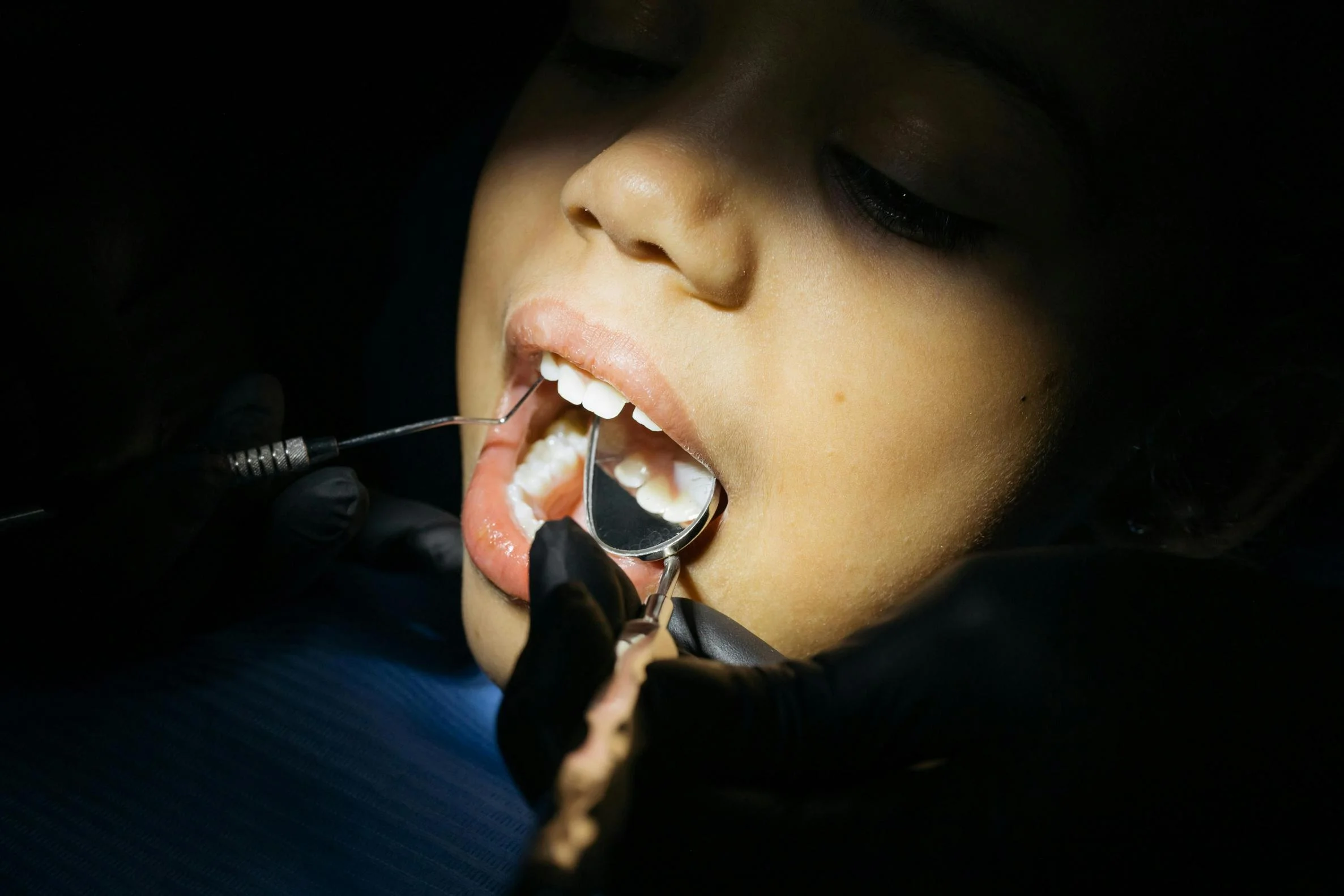 Bite Correction vs. Cosmetic Straightening: Expert Advice for Lasting Results