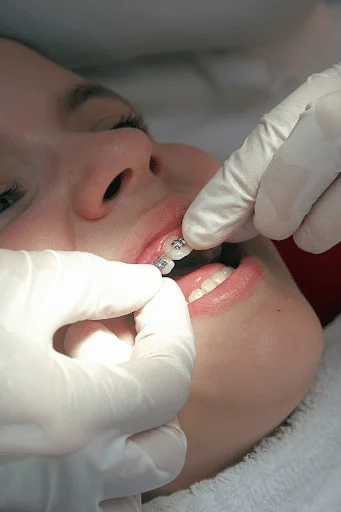 Orthodontist adjusting brackets during an orthodontic adjustment appointment